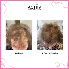 Actiiv - Recover Thickening Shampoo Treatment for Women - 16oz / 473ml [Beauty] Beauty Actiiv